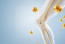 როდის არის საჭირო კოლაგენი სახსრებისთვის? – ძირითადი ნიშნები