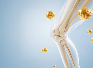 როდის არის საჭირო კოლაგენი სახსრებისთვის? – ძირითადი ნიშნები