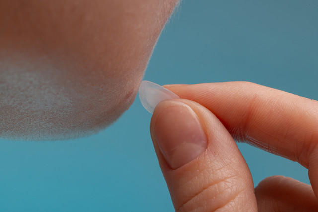 girl-with-acne-stick-round-acne-patch-her-cheek-using-acne-patches-treatment-pimple-rosacea-closeup